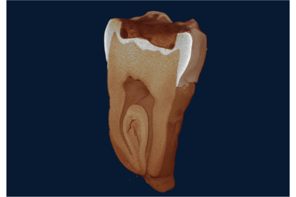 NeoScan N60 Equipo - Paralab Bio distribuye equipos de micro-CT en España