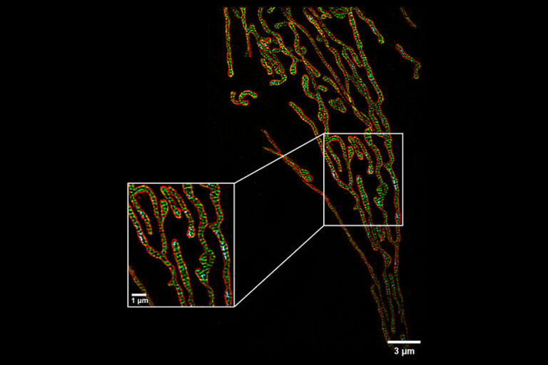 MI-SIM Equipo - Paralab Bio distribuye equipos de microscopía en España